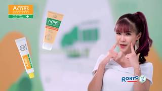 ACNES  MỜ SẸO GIẢM THÂM NHANH  KHỞI MY 15S [upl. by Siclari]