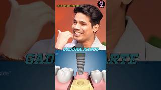 Dental Implant Is Painful 😖 short youtubeshorts gamerfleet [upl. by Maryrose]