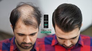 Hair Style For Very Thin amp Balding Hair by using Hair Fibers 2022 [upl. by Aihn]