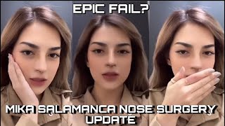 🔴Mika Salamanca Nose REVEAL EPIC FAIL😥  Trending [upl. by Amelina]