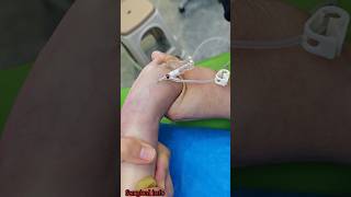 How to insert iv cannula in children song trending shorts [upl. by Jemimah]