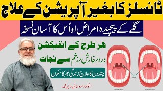 tonsillitis Symptoms treatment by Akhun zanda haji Deen Muhammad [upl. by Notled589]