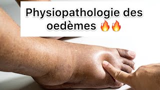 📍 Physiopathologie des Oedèmes par khadidja ferdj 🔥 [upl. by Amin]