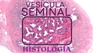 Histología de Vesícula seminal [upl. by Aiciram]