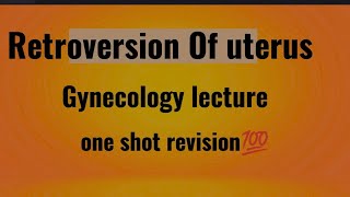 RETROVERSION OF UTERUS  Gynecology lecture [upl. by Aleck]