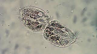 Microorganismos Protozoos Paramecio vorticela Euglena Diatomeas [upl. by Latreshia968]