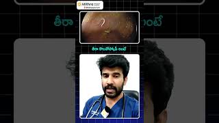 తిన్న వెంటనే మోషన్ వెళ్తున్నారా అయితే ఈ వీడియో చూడండిDrVikranth Chunduri [upl. by Aissatsana]