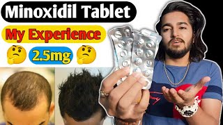 Minoxidil Tablet Experience  Lonitab 25mg Minoxidil Tablet [upl. by Crispen]