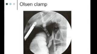 IntraOperative Imaging of the biliary system  Cholangiography [upl. by Ethyl]