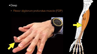 Forearm flexor muscles [upl. by Fachanan]