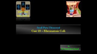 Ultrasound Case 23  Fibromatosis Colli [upl. by Nyllek468]