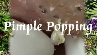 Pimple amp Blackheads Popping  24 [upl. by Neibaf]