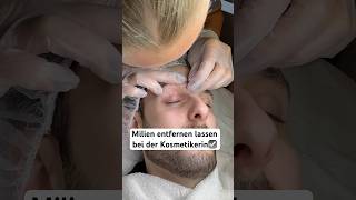 Milien entfernen☑️ hautpflege skincare gesichtsbehandlung kosmetiker ausreinigen [upl. by Suzzy]