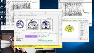 EEG Vielight 1st 2min vs 15 17min light on [upl. by Iuq]