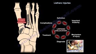 Lisfranc Injuries  Everything You Need To Know  Dr Nabil Ebraheim [upl. by Euqinomod813]