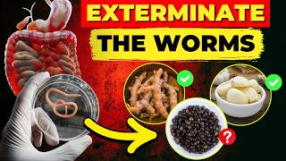 12 Foods That Destroy Intestinal Parasites EXTERMINATE The Worms [upl. by Ilam954]