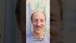 Man Going Bald Instantly Shaves 10 YEARS Off His Age [upl. by Araiek]