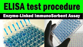 ELISA test procedure  EnzymeLinked Immunosorbent Assay step by step [upl. by Christiano199]