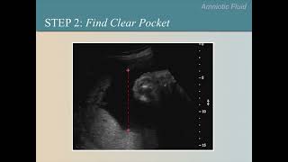 Ultrasound Training Course 10 part 1 [upl. by Floris]