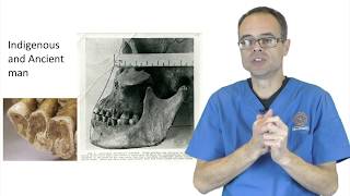 The Cause And Cure Of Bruxism And Clenching By Dr Mike Mew [upl. by Einnep]