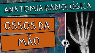 Anatomia radiológica RX dos MEMBROS SUPERIORES Parte 25  MÃO  METACARPOS E FALANGES [upl. by Asirahc716]