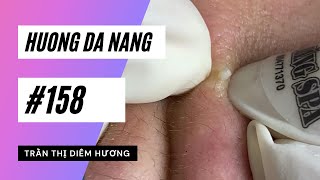 158  Huong Da Nang [upl. by Aenej]