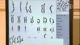 FWU  Chromosomen des Menschen  Erbkrankheiten und Karyogramme [upl. by Rhtaeh]