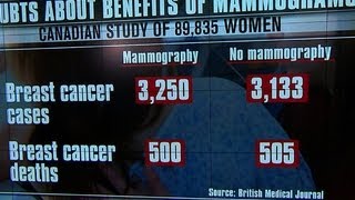 Mammogram study Test doesnt save lives of women 4059 [upl. by Kcirdet444]