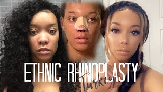 RHINOPLASTY QampA I GOT A NOSE JOB IN TURKEY and this happened  Peyton Charles [upl. by Gine]