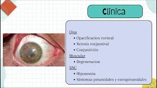 Xeroderma Pigmentosum [upl. by Garnette]