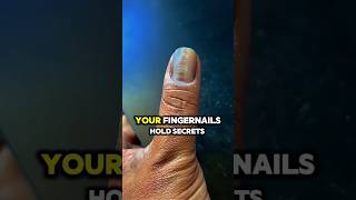 Fingernails Can Predict Your Death ☠️health facts helthtips [upl. by Arlen]