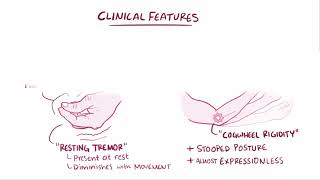 Parkinsons Disease  Osmosis [upl. by Vachil]