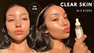 MY UPDATED SKINCARE ROUTINE  unsponsored skincare for acne [upl. by Eidnak]