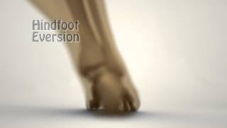 Demonstration of Forefoot influence on Proximal Kinematics Valgus vs Varus [upl. by Charlton596]