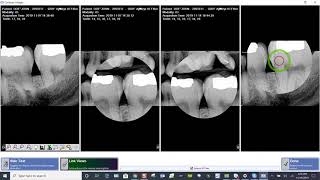 Training Apteryx XrayVision DCV Comparing Images in XVCapture [upl. by Nowahs]