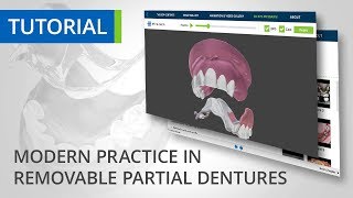 Removable Partial Dentures Tutorial [upl. by Peterus]