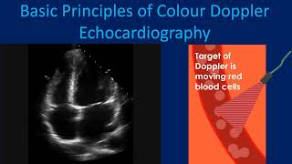 Basic Principles of Colour Doppler Echocardiography [upl. by Ezmeralda]