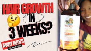 WHY MARY RUTH LIQUID MULTIVITAMIN HAIR GROWTH IS WORTH THE HYPE  Before amp After Pictures [upl. by Cristine664]