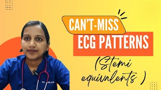 STEMI Equivalent  Cant Miss ECG Patterns [upl. by Englebert]