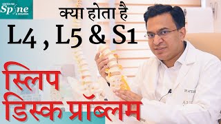 क्या होता है L4 L5 amp S1  स्लिप डिस्क प्रॉब्लम Slip Disc Complete Info amp Treatment in Hindi [upl. by Reamy]