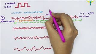 Electroencephalogram EEG  Waves  Physiology [upl. by Elletse911]