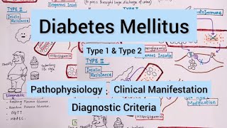 Diabetes Mellitus Type 1 amp Type 2 [upl. by Morrie]