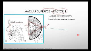 Cefalometria de BIMLER Puntos planos y factores CLASE MAGISTRAL [upl. by Inaboy]