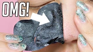 CRAZY BLACKHEAD TRICK Baking Soda  Pore Strip [upl. by Marie-Ann214]