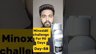 Minoxidil challenge For 90 DaysDay58haircare minoxidil viralreels viralshorts trendingshorts [upl. by Ivers104]