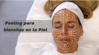 Peeling para Manchas en la Piel [upl. by Nekciv]