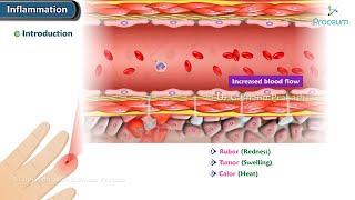 1 Introduction to Acute and Chronic Inflammation Animation [upl. by Dhar295]