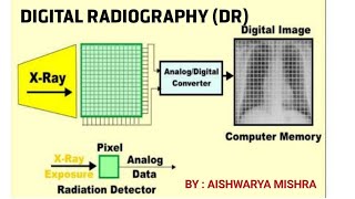 DIGITAL RADIOGRAPHY DR PART1  BY AISHWARYA MISHRA [upl. by Eniortna]