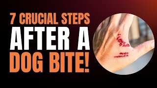 Dog Bite 7 Crucial Steps to Take After a Dog Bite Immediately [upl. by Enelrac]