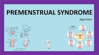 Premenstrual Syndrome Algorithm RCOG Guidelines with important MCQs [upl. by Echikson991]